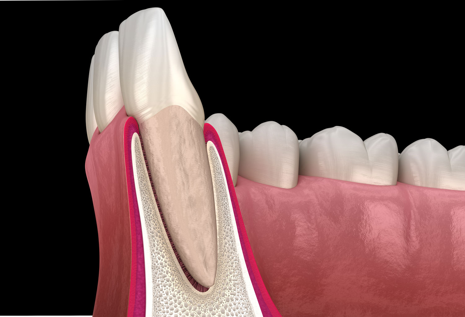 歯茎が健康な状態の画像