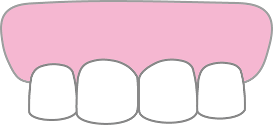 すきっ歯Cのイメージ